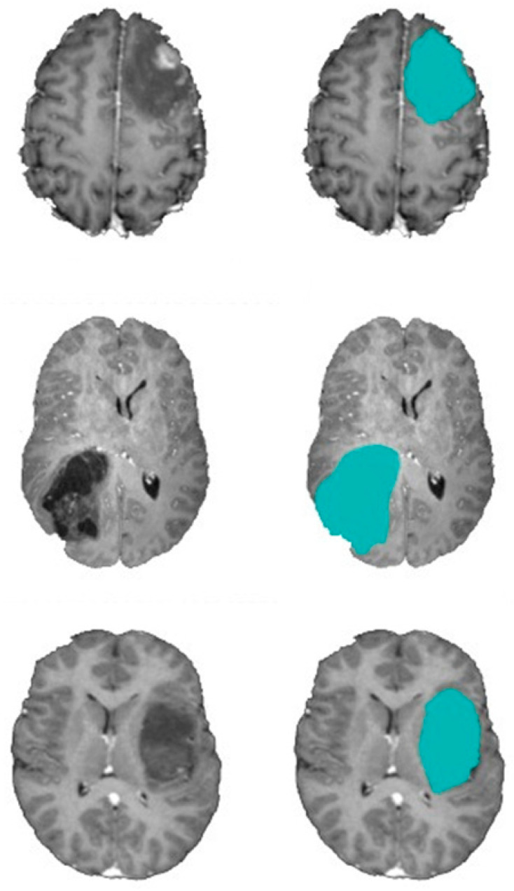 Figure 19