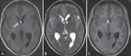 Figure 1(A-C):