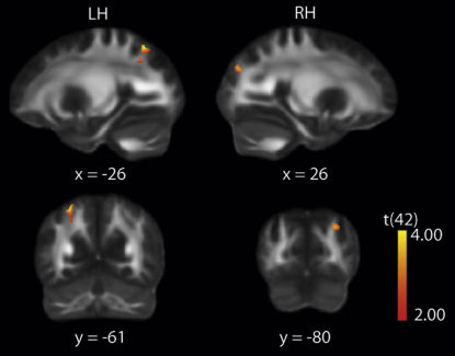 Figure 4