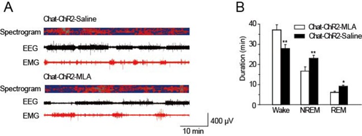 Figure 6—figure supplement 1.