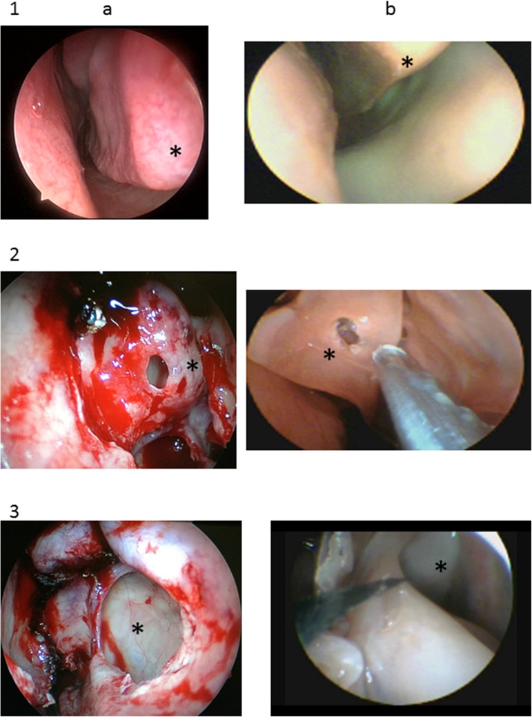 Fig 2