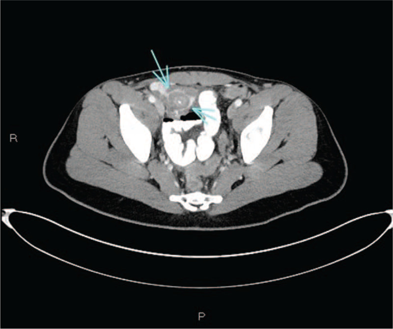 FIGURE 1