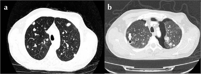 Figure 2. a, b