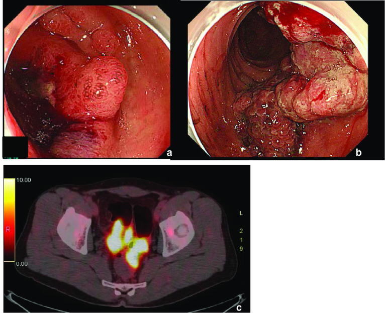 Fig. 2