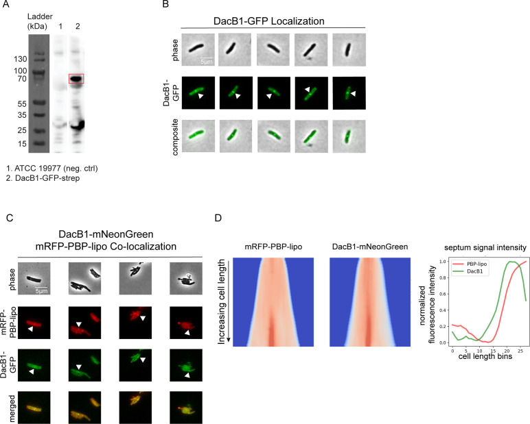 Figure 6—figure supplement 4.