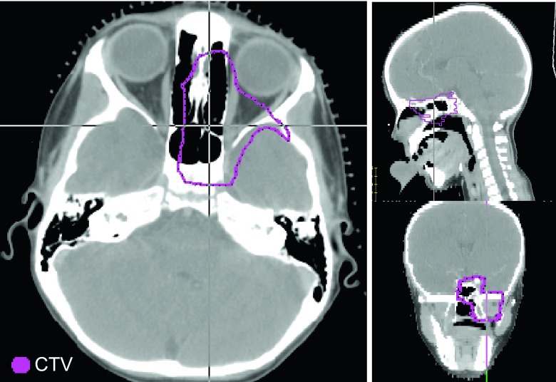 FIG. 1.