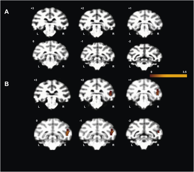 Figure 3—figure supplement 1.