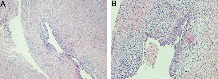 Fig.1