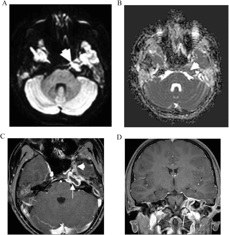 Fig 2