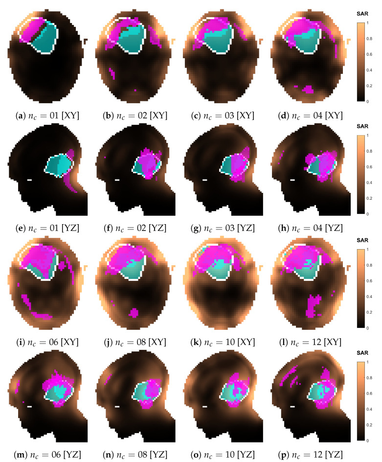 Figure 16