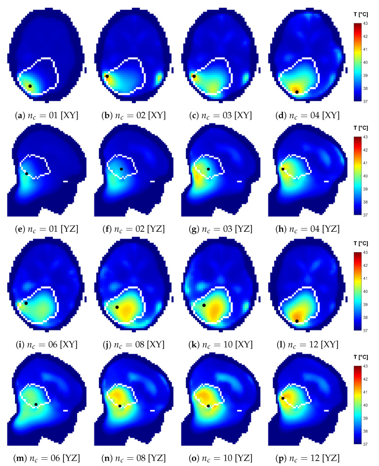 Figure 17