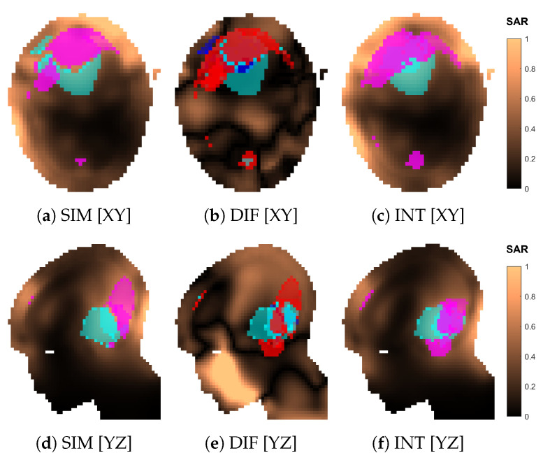 Figure 12