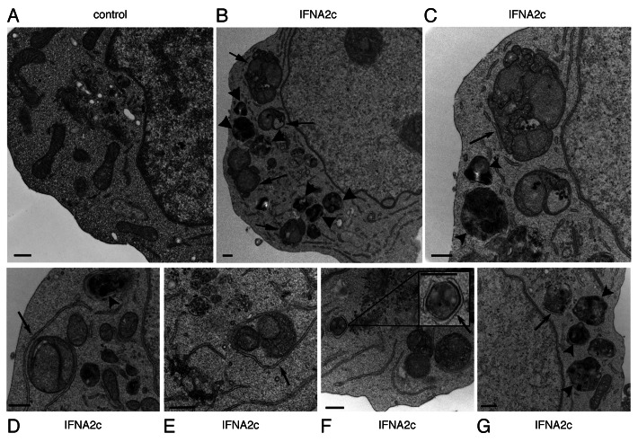 graphic file with name auto-9-683-g4.jpg