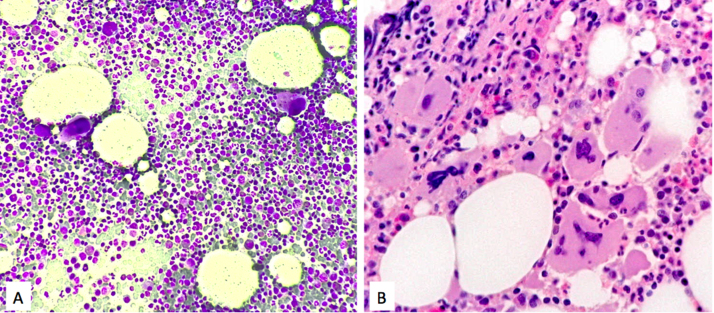 Fig. 2