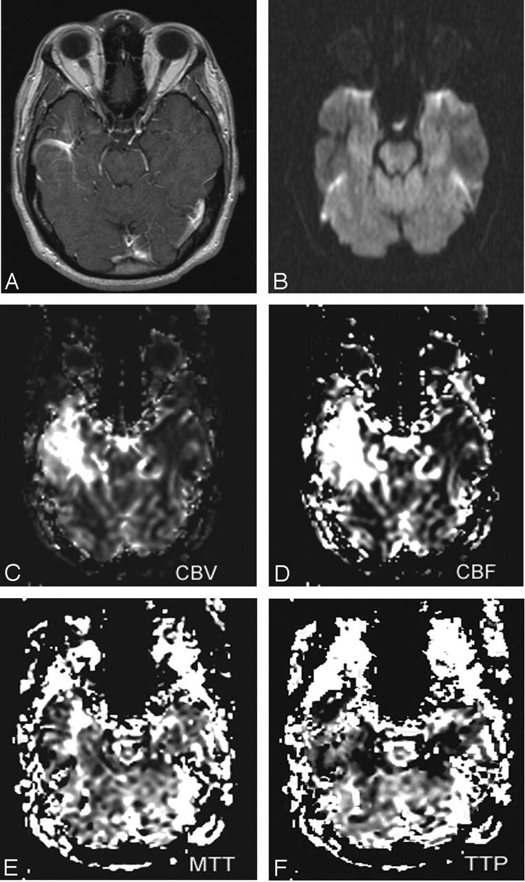 Fig 2.