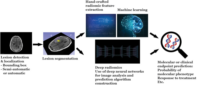 Overview of the radiomic workflow. The major steps in the radiomic workflow consist of lesion identification and localization, segmentation, feature extraction, and prediction model construction. In the short term, lesion detection and localization may be facilitated either by directing the algorithm using a bounding box approach by the radiologist or, alternatively, by the radiologist pointing at the lesion of interest using a cursor. However, in the long term, lesion identification may also be performed automatically by the algorithm. It should be noted that regardless of the degree of automation, these steps would be performed under the supervision of the expert radiologist, with the ability to make adjustments or modifications as needed.