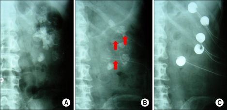 FIG. 1