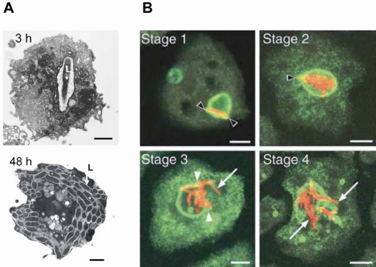 Fig. (1). Infection of D. discoideum with different pathogens.