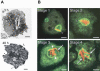 Fig. (1). Infection of <i>D. discoideum</i> with different pathogens.