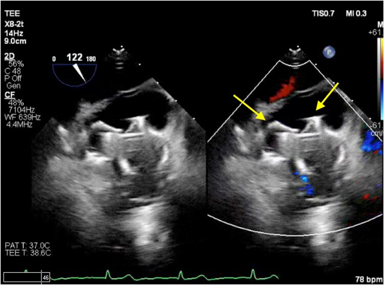 Figure 5