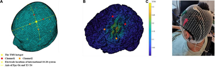 FIGURE 2