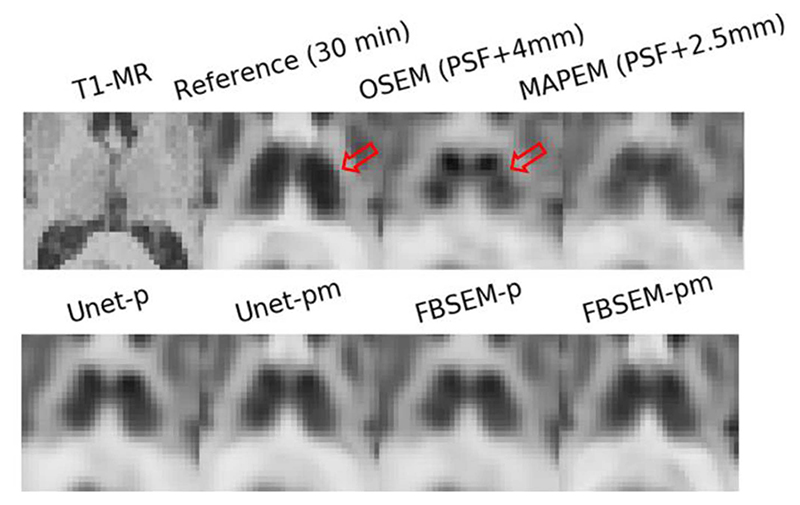 Fig. 9