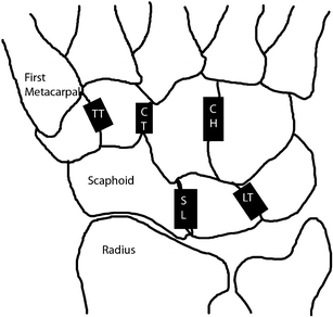 Fig. 2