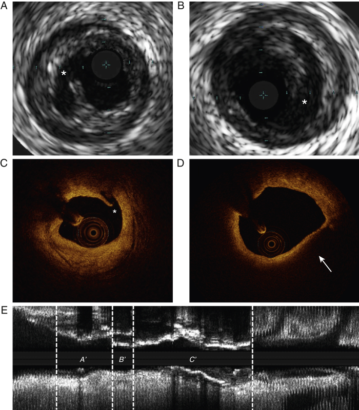 Figure 2