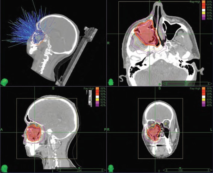 Figure 1: