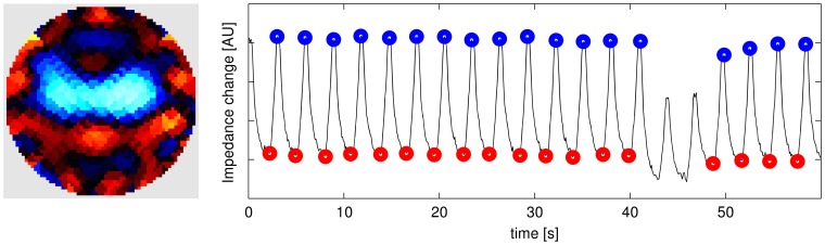 Sample image and identified end-inspiratory (blue) and end-expiratory (red) events.