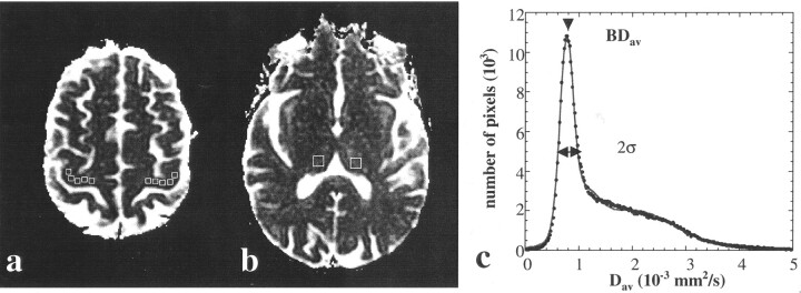 Fig 1.