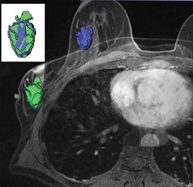 Figure 2a: