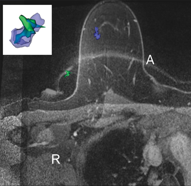 Figure 2c: