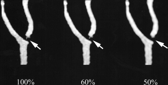 fig 3.