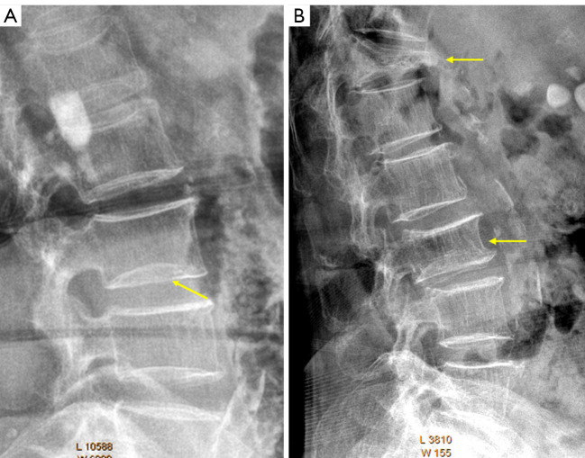 Figure 16