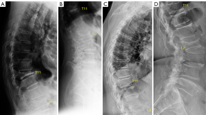 Figure 11