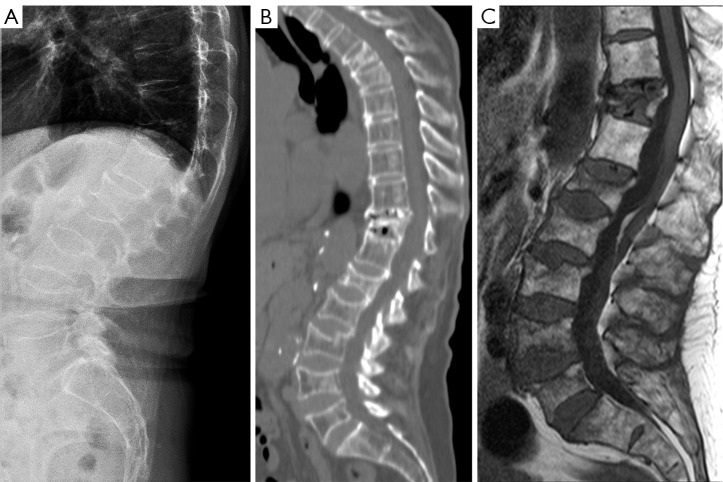 Figure 14