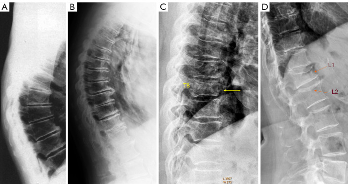 Figure 12