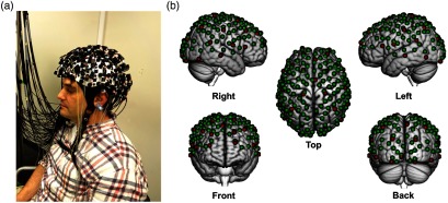 Fig. 2