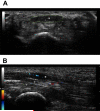 Fig. 6