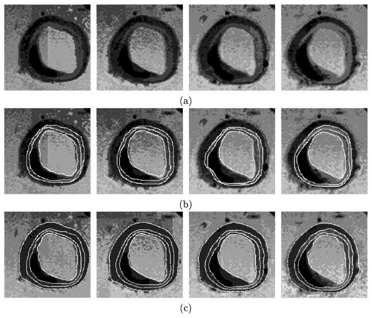 Fig. 13