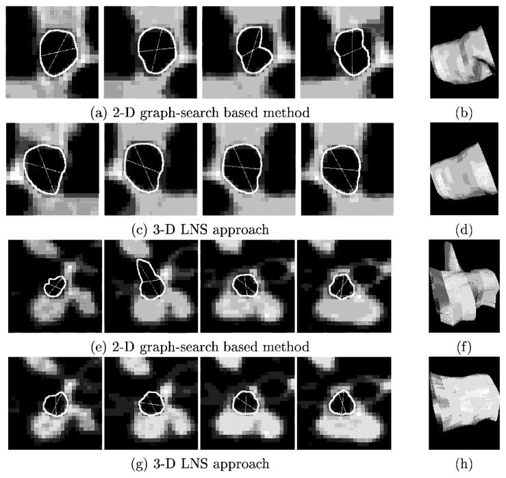 Fig. 12