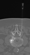 Fig 1.