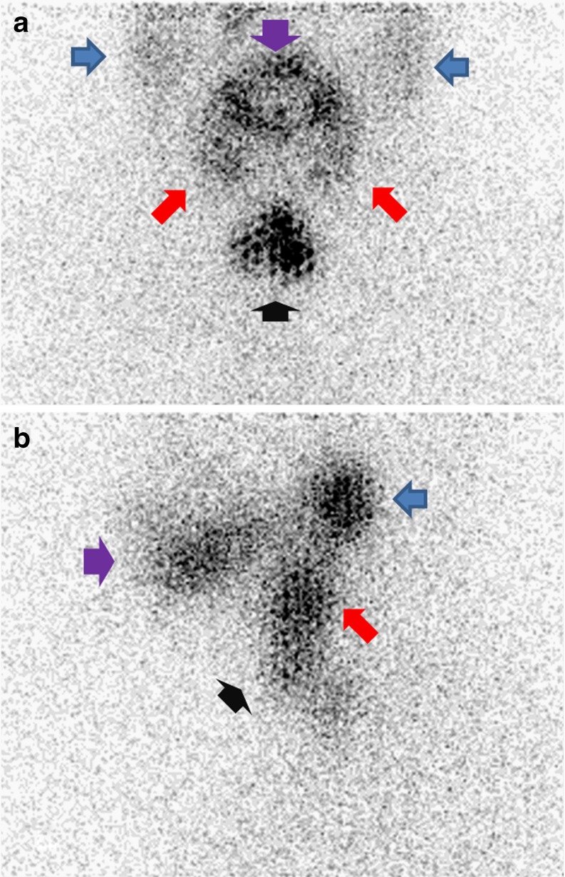 Fig. 1