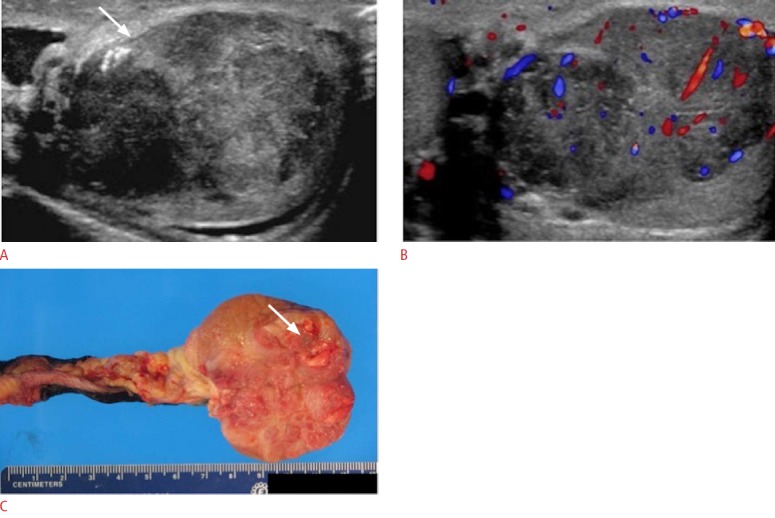 Fig. 22.