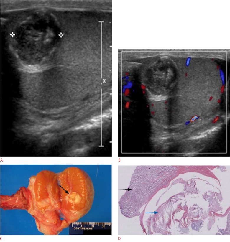 Fig. 14.