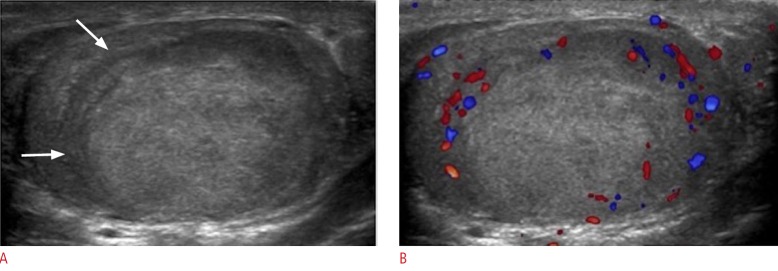 Fig. 21.