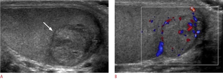 Fig. 20.