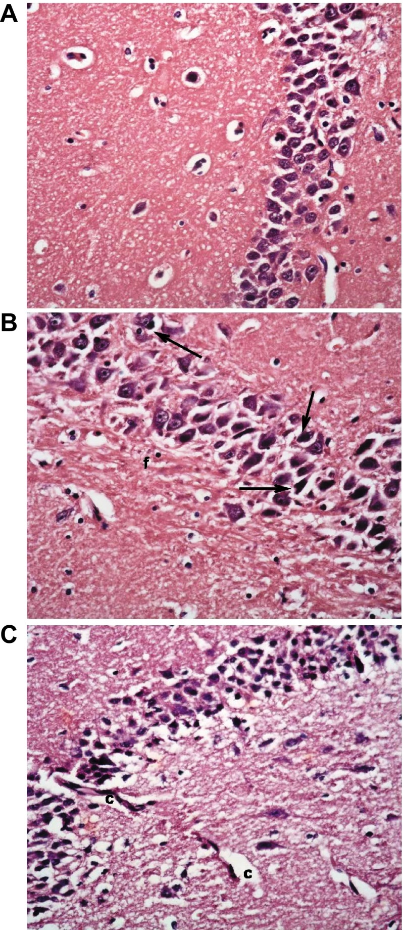 Figure 11. 