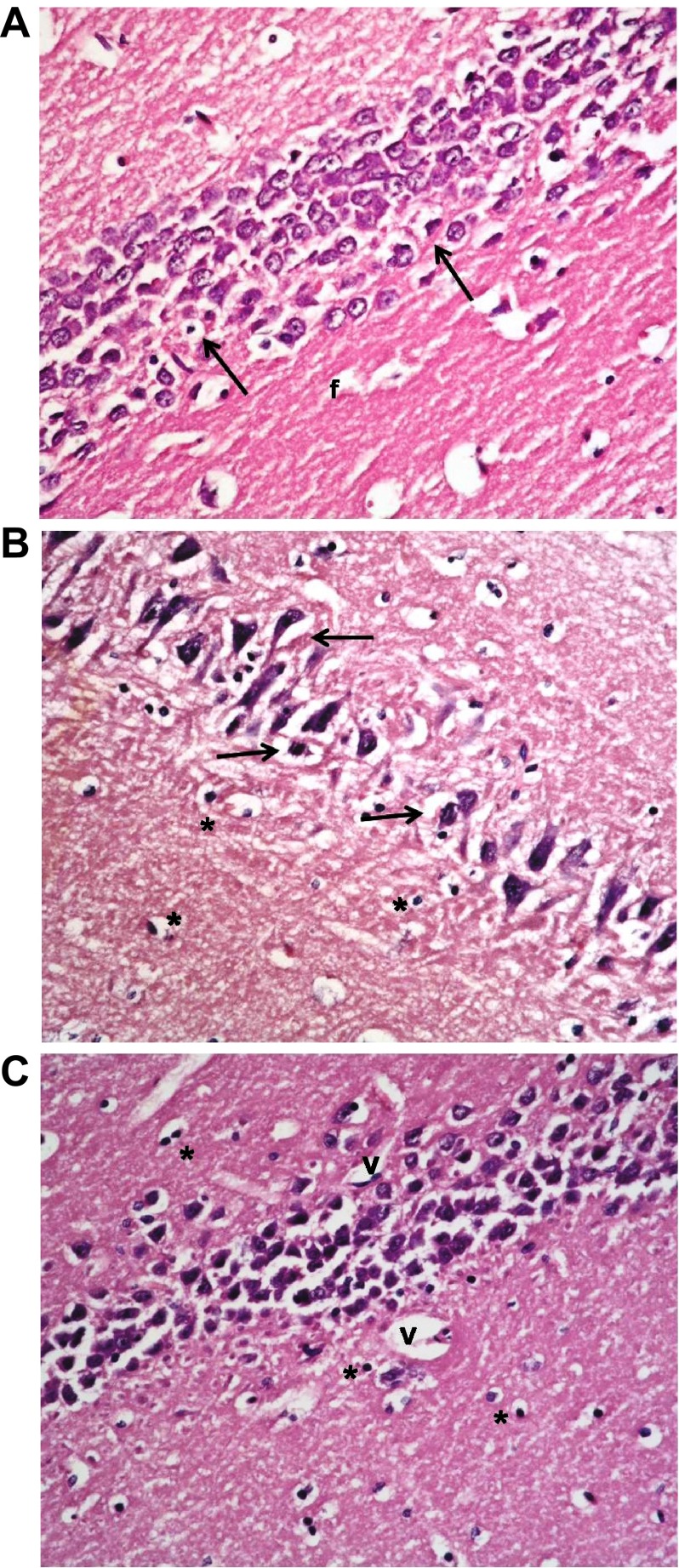 Figure 13. 